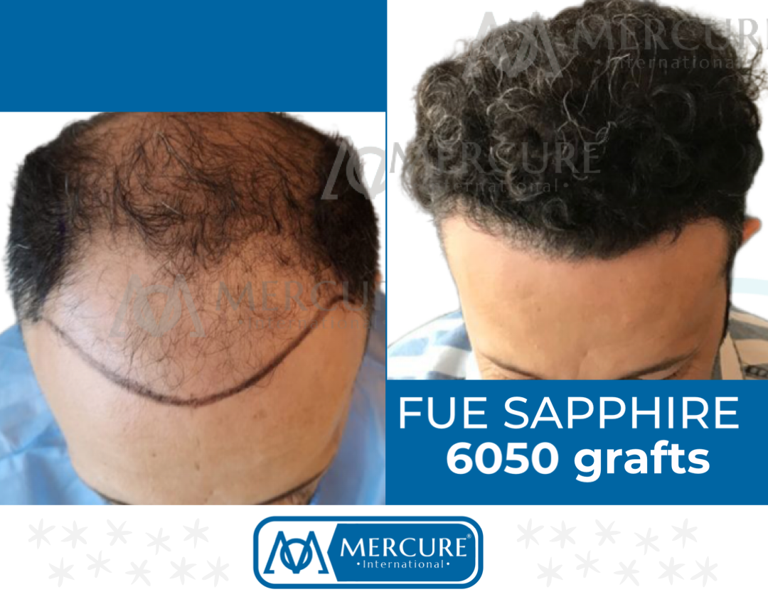 FBB1EE26-E939-49B7-B93A-707D0CD6263C