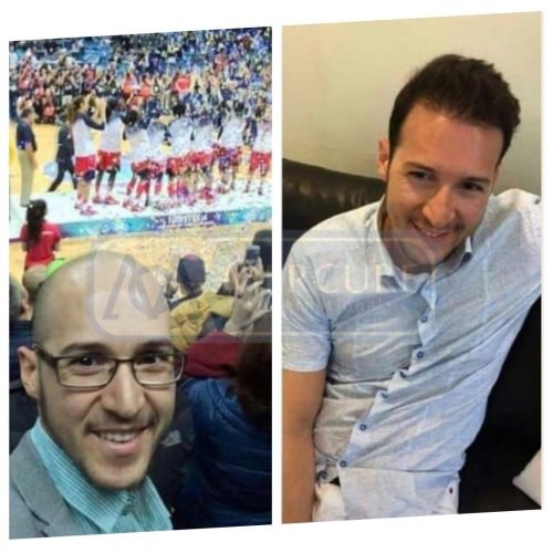 High-Density-Hair-Transplant-Mercure-Istanbul-Clinics.jpg